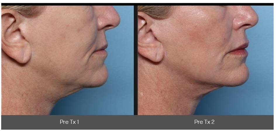 ダウンタイムなし